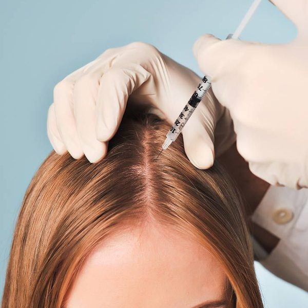 hair mesotherapy